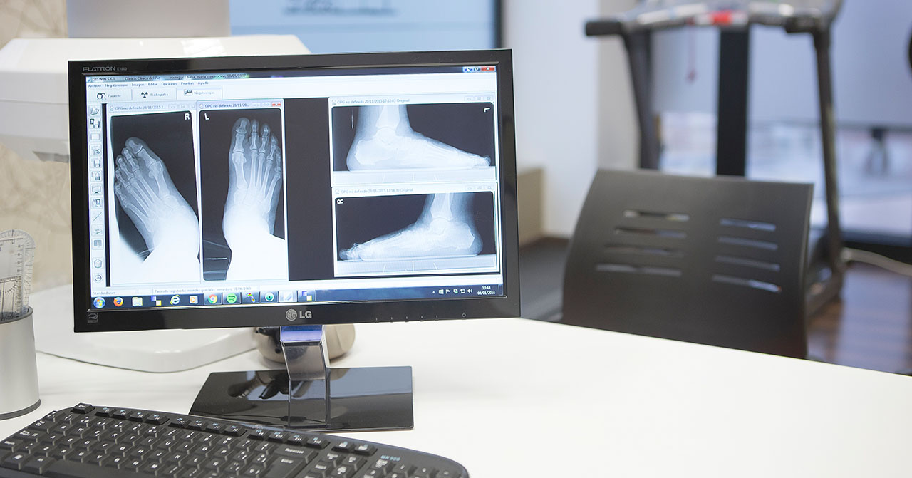 Estudio Biomecánico Podología - Clínica del Pie Ponferrada